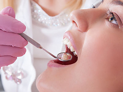A person receiving dental care, with a dental professional using a handpiece on their teeth while wearing gloves.